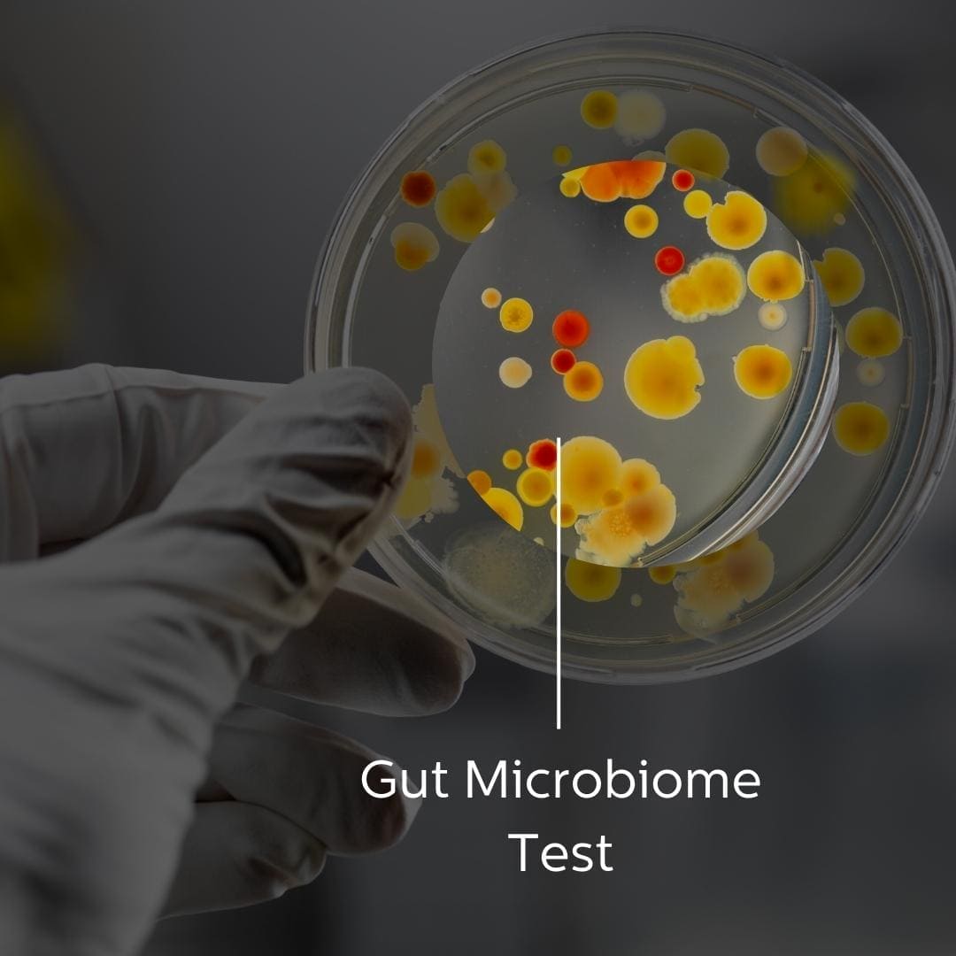 Comprehensive Gut Microbiome Test
